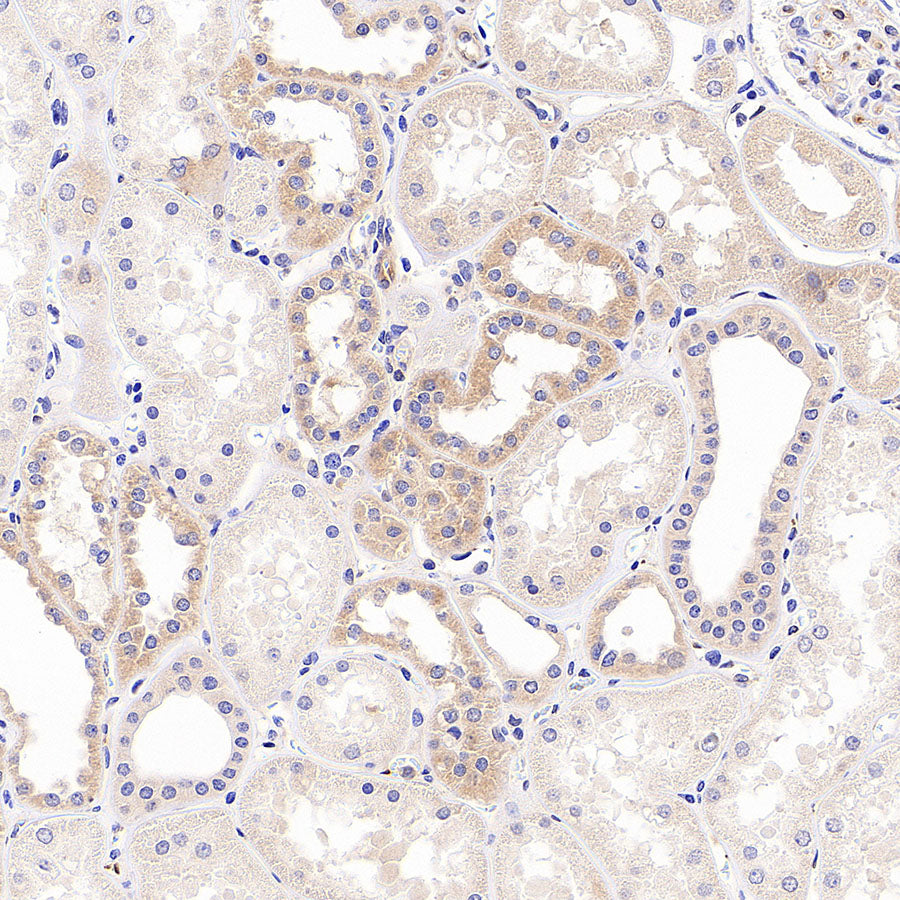 IFIT2 Recombinant Rabbit mAb (S-6029)