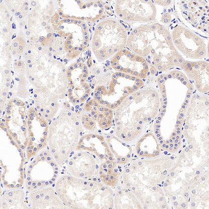 IFIT2 Recombinant Rabbit mAb (S-6029)