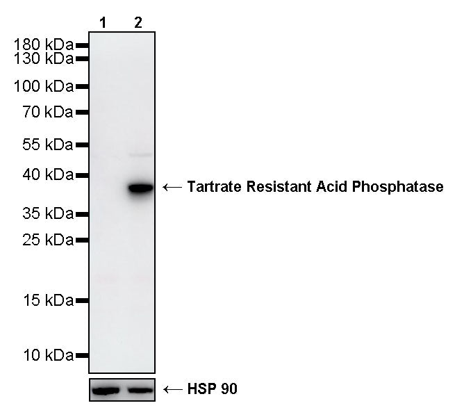 Tartrate Resistant Acid Phosphatase Recombinant Rabbit mAb (S-5960)