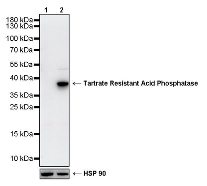 Tartrate Resistant Acid Phosphatase Recombinant Rabbit mAb (S-5960)