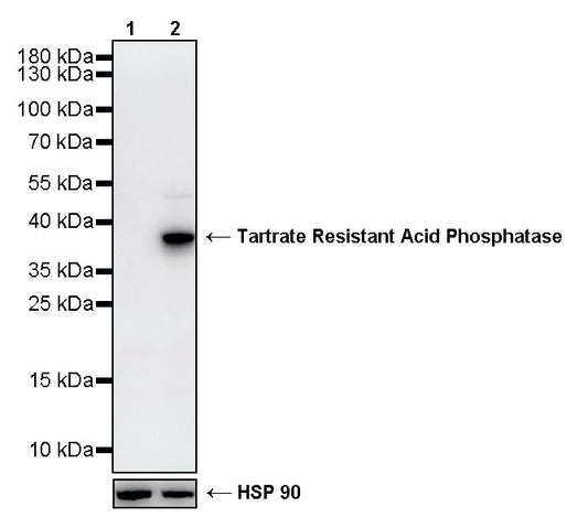 Tartrate Resistant Acid Phosphatase Recombinant Rabbit mAb (S-5960)