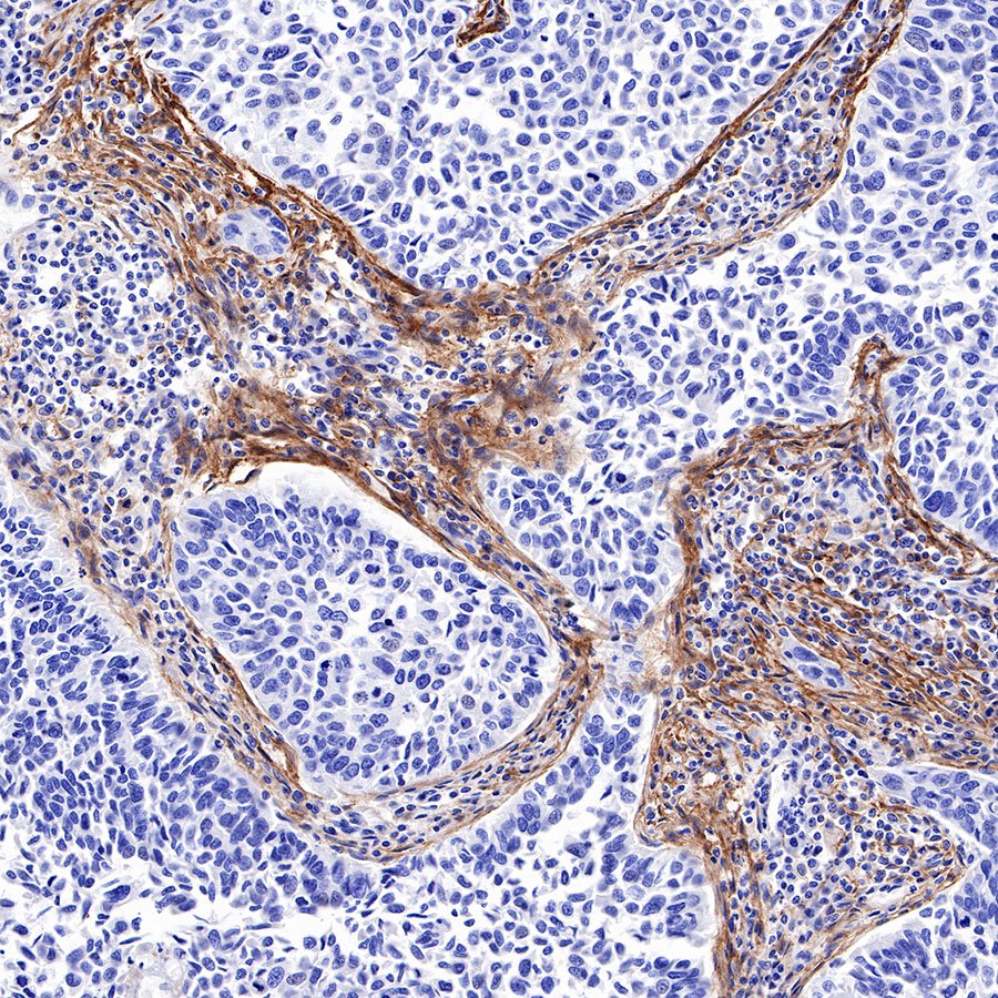 FAP Recombinant Rabbit mAb,PBS Only (SDT-R132)
