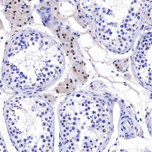 S-RMab®Steroidogenic Factor 1/SF-1 Recombinant Rabbit mAb (SDT-1666-11)