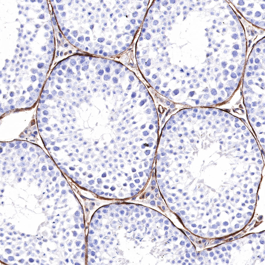 S-RMab® alpha smooth muscle Actin (SMA) Recombinant Rabbit mAb,PBS Only (SDT-301-142)