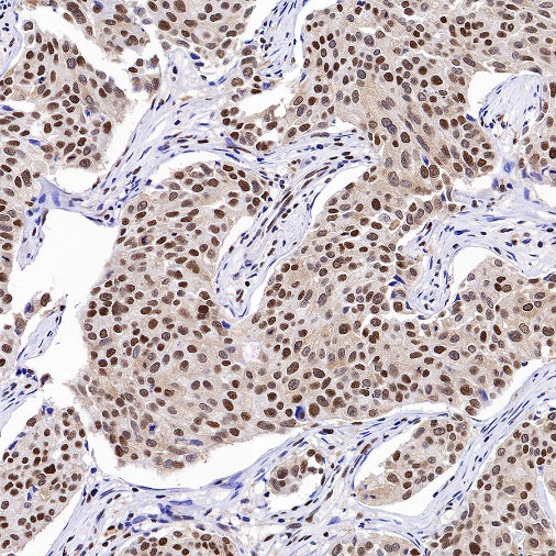 RPA70 Recombinant Rabbit mAb (S-1653-9)
