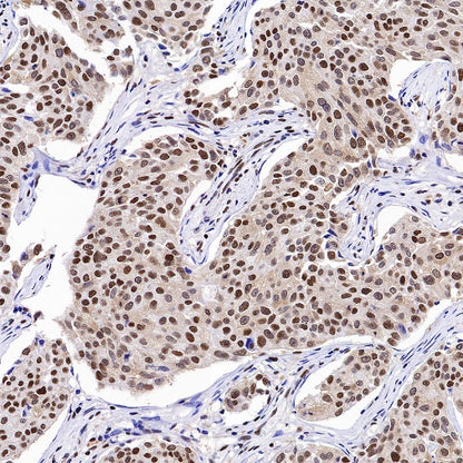 RPA70 Recombinant Rabbit mAb (S-1653-9)