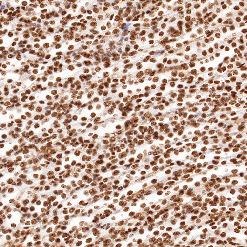nmt55/p54nrb Recombinant Rabbit mAb (S-1745-48)