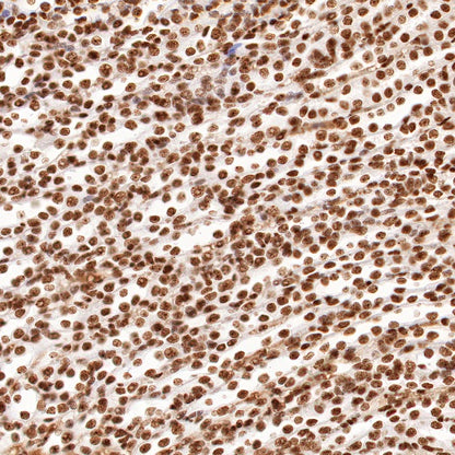 nmt55/p54nrb Recombinant Rabbit mAb (S-1745-48)
