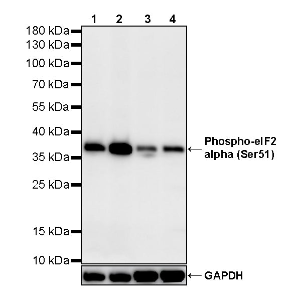 Phospho-eIF2 alpha (Ser51) Recombinant Rabbit mAb (S-6195)