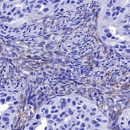 SDF1/CXCL12 Recombinant Rabbit mAb (SDT-3675)