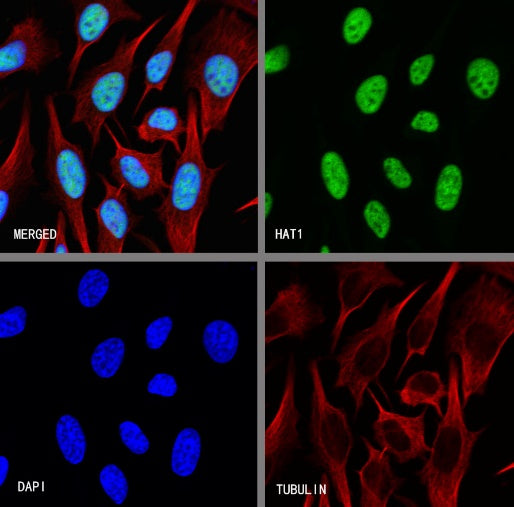 HAT1 Recombinant Rabbit mAb (S-2429-14)