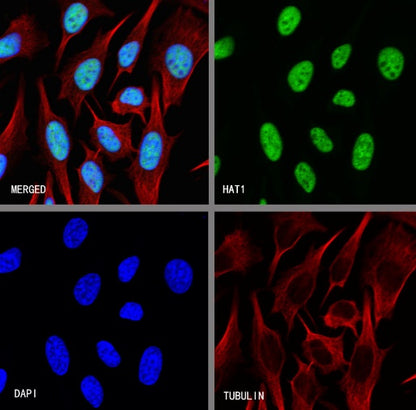HAT1 Recombinant Rabbit mAb (S-2429-14)
