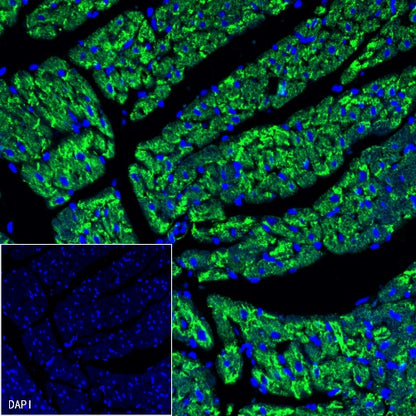 S-RMab® Desmin Recombinant Rabbit mAb (SDT-109-114)