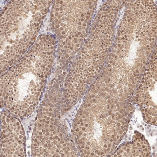 XPO1/CRM1 Recombinant Rabbit mAb (S-3309-7)