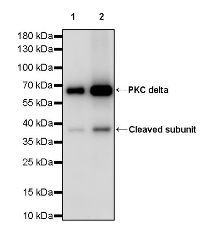 PKC delta Recombinant Rabbit mAb (S-2611-39)