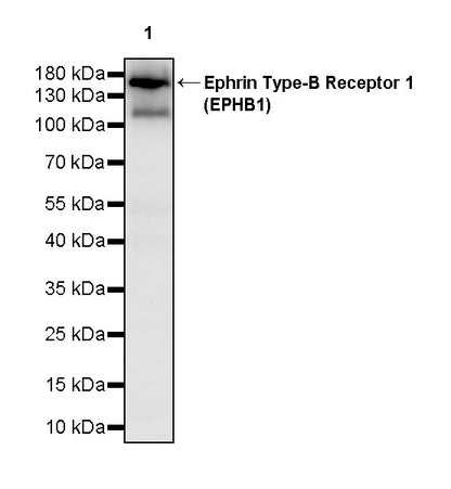 Ephrin Type-B Receptor 1 (EPHB1) Recombinant Rabbit mAb (S-4151-65)