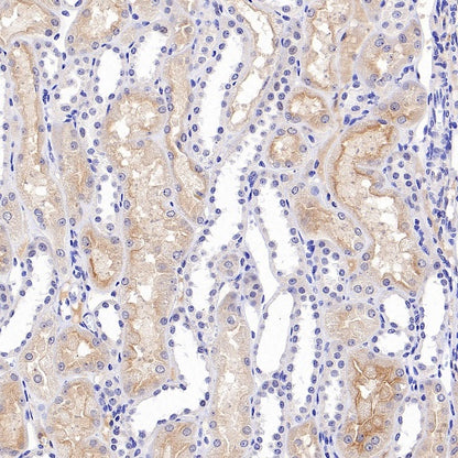 Human folate receptor alpha Recombinant Rabbit mAb (SDT-719-684)