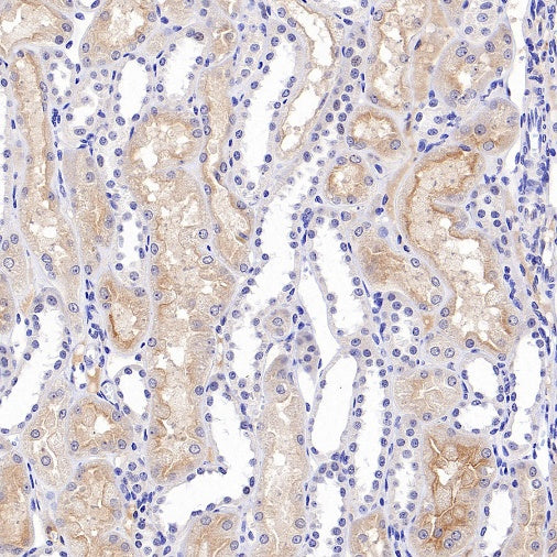 Human folate receptor alpha Recombinant Rabbit mAb (SDT-719-684)