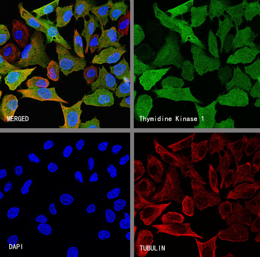 Thymidine Kinase 1 Recombinant Rabbit mAb (S-4127-43)
