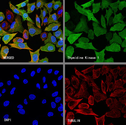 Thymidine Kinase 1 Recombinant Rabbit mAb (S-4127-43)