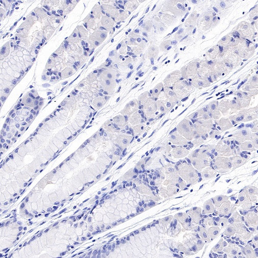 S-RMab® Helicobacter pylori Recombinant Rabbit mAb (HRP Conjugate) (S-R273)