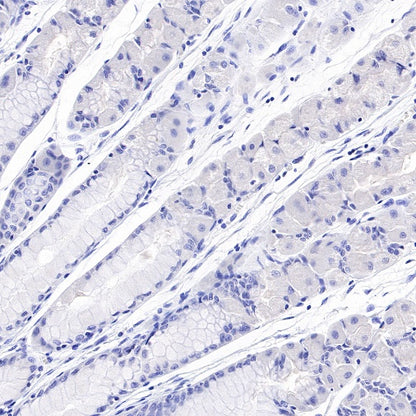 S-RMab® Helicobacter pylori Recombinant Rabbit mAb (HRP Conjugate) (S-R273)