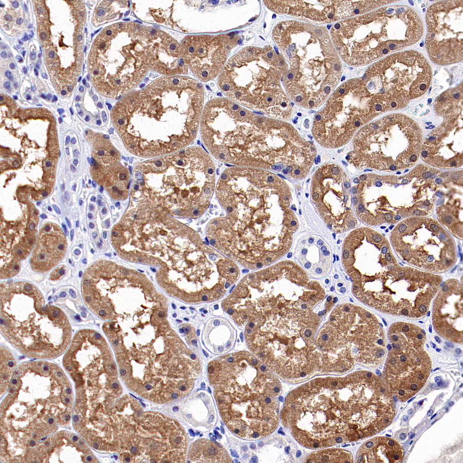 Sec61B Rabbit Polyclonal Antibody