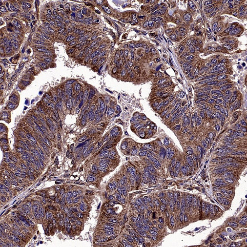 Bax Recombinant Rabbit mAb (S-2603-124)