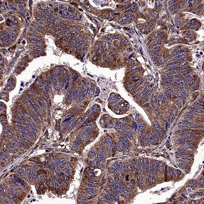 Bax Recombinant Rabbit mAb (S-2603-124)