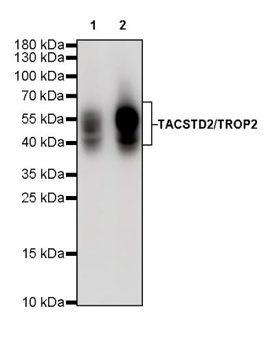 TACSTD2/TROP2 Recombinant Rabbit mAb (S-R238)