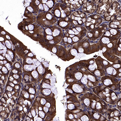 AMPKβ1/2 Recombinant Rabbit mAb (S-2728-26)
