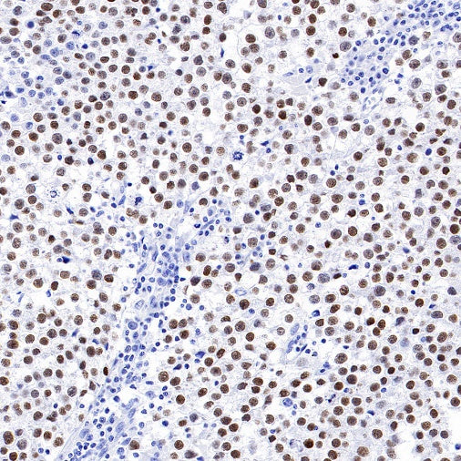 Nanog Recombinant Rabbit mAb (S-1823-8)