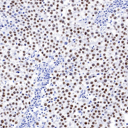 Nanog Recombinant Rabbit mAb (S-1823-8)