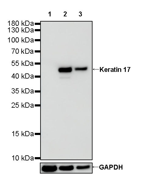 Keratin 17 Recombinant Rabbit mAb (SDT-011-43)