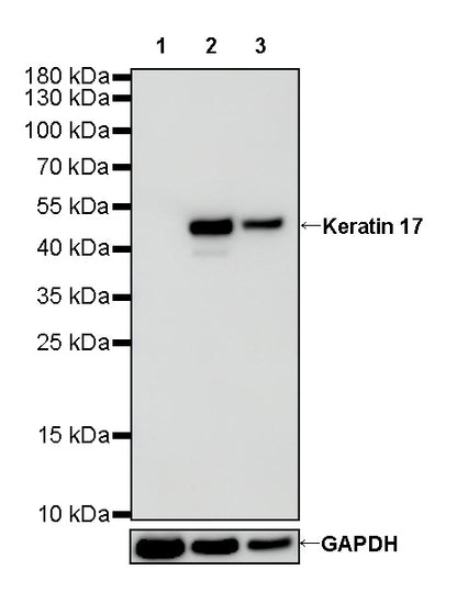 Keratin 17 Recombinant Rabbit mAb (SDT-011-43)