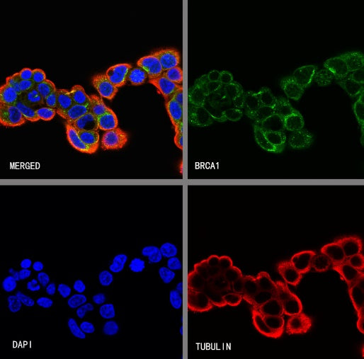 BRCA1 Recombinant Mouse mAb (S-4707)