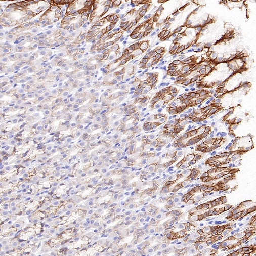 Integrin beta 6 Recombinant Rabbit mAb (SDT-1445-78)