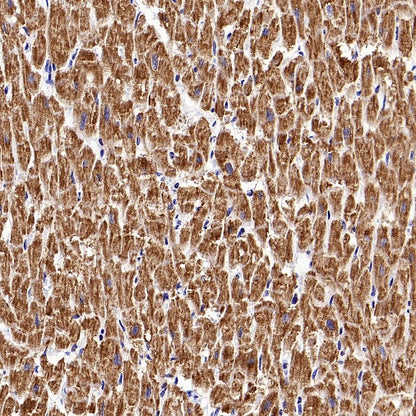VDAC1 + VDAC2 + VDAC3 Rabbit Polyclonal Antibody