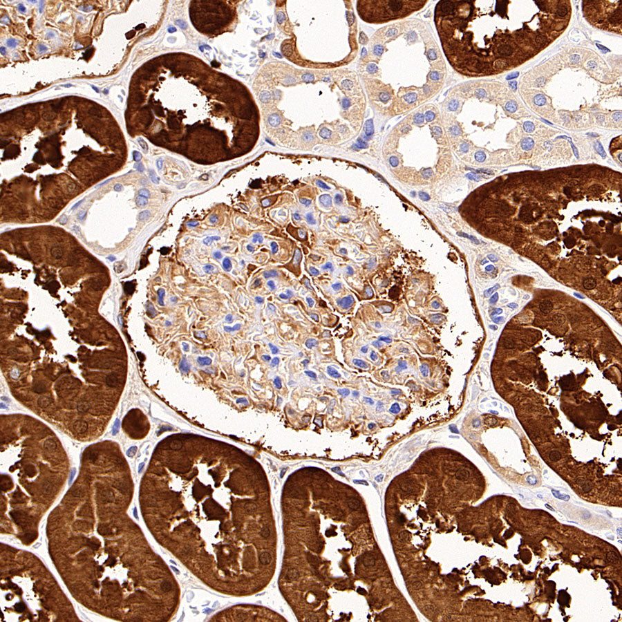 HPD Recombinant Rabbit mAb (S-4536-65)