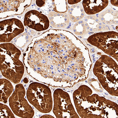 HPD Recombinant Rabbit mAb (S-4536-65)