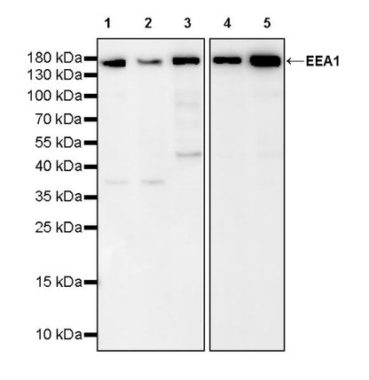 EEA1 Recombinant Rabbit mAb (S-2604-39)