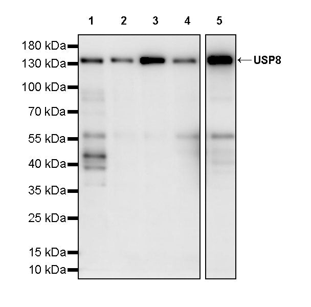 USP8 Recombinant Rabbit mAb (S-3848-146)