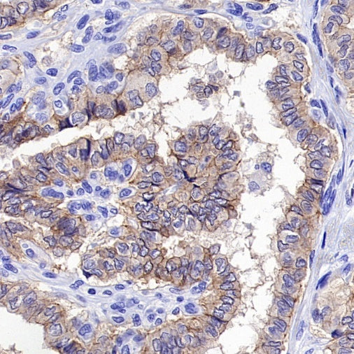 Occludin Recombinant Rabbit mAb (SDT-4588)