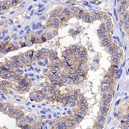 Occludin Recombinant Rabbit mAb (SDT-4588)