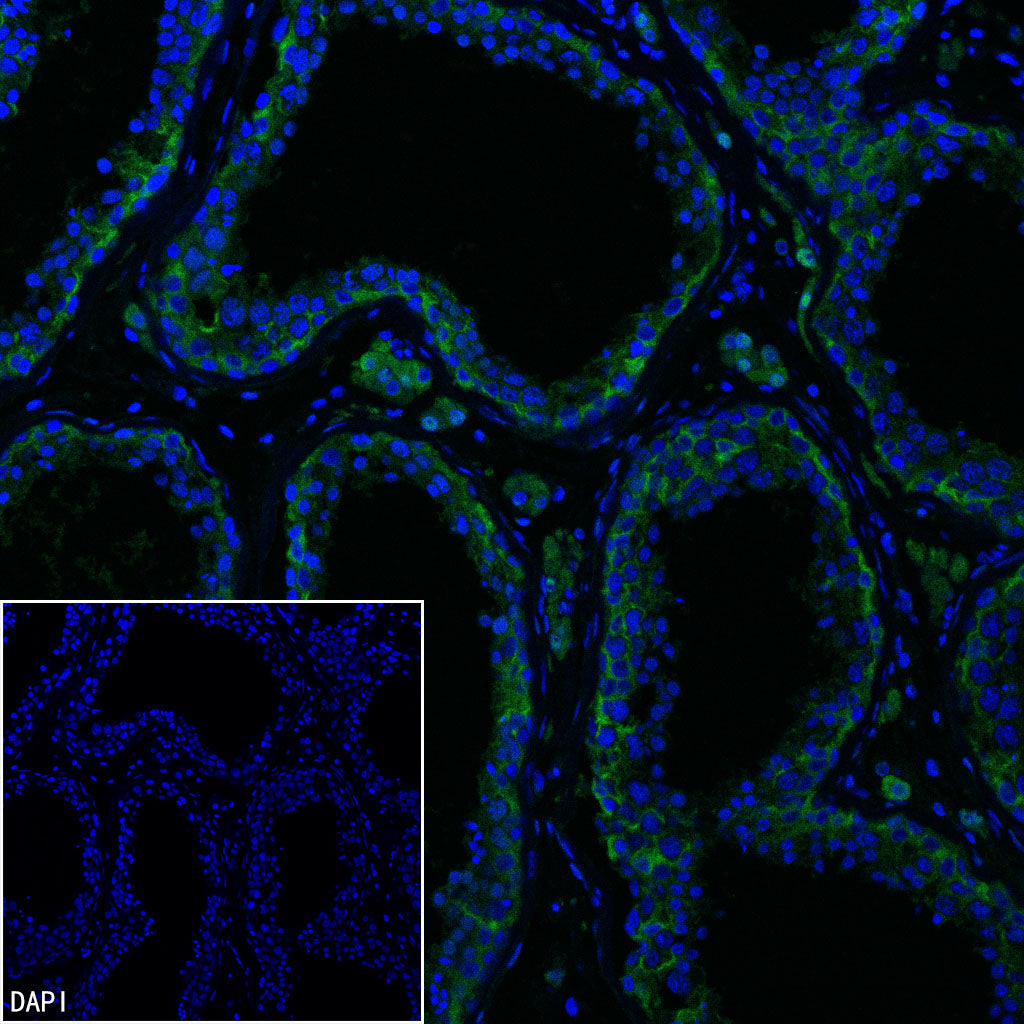Inhibin alpha Recombinant Rabbit mAb (SDT-3212-24)