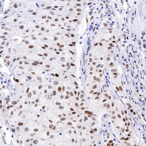 APE Recombinant Rabbit mAb (S-R349)
