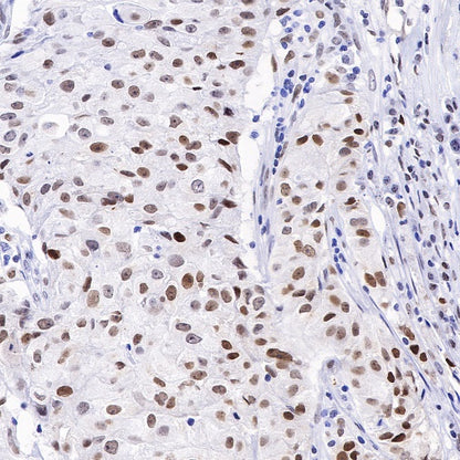 APE Recombinant Rabbit mAb (S-R349)