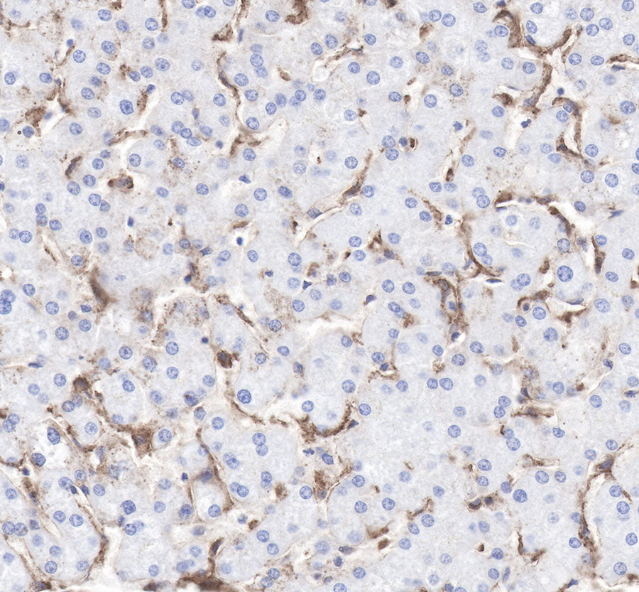 LDL receptor Recombinant Rabbit  mAb (SDT-057-57)