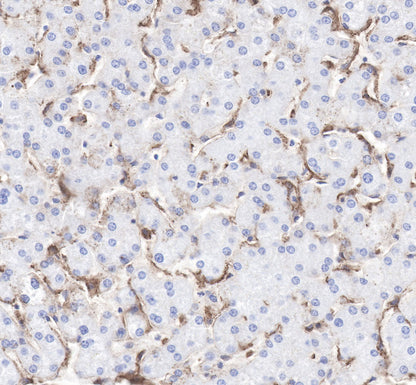 LDL receptor Recombinant Rabbit  mAb (SDT-057-57)