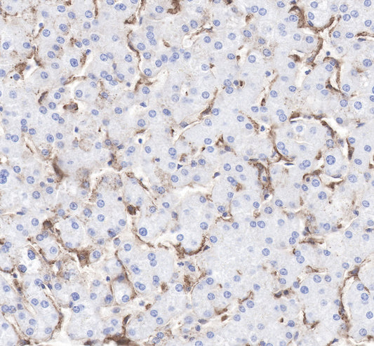 LDL receptor Recombinant Rabbit  mAb (SDT-057-57)